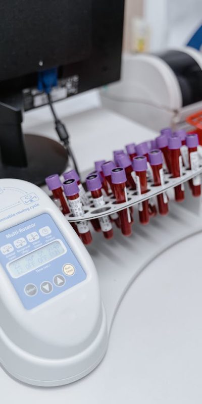 Equipo de PCR en tiempo real (qPCR) para análisis microbiológico oral